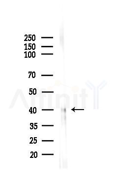 BVES Antibody - Western blot analysis of lysates from HepG2 cells(starvation,24h treatment), using BVES Antibody at 1/1000 dilution.