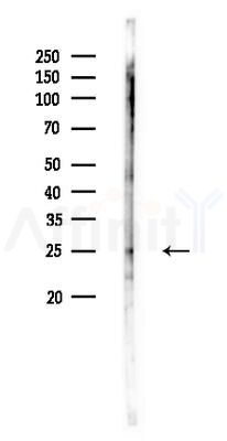 DDIT3/CHOP Antibody - Western blot analysis of lysates from HUVEC cells, using DDIT3/CHOP Antibody at 1/1000 dilution.