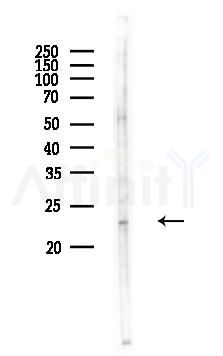 DDIT3/CHOP Antibody - Western blot analysis of lysates from Mouse liver, using DDIT3/CHOP Antibody at 1/1000 dilution.