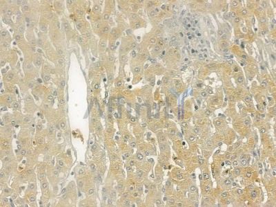 DOK4 Antibody - DF6029 at 1/100 staining human normal lung tissue by IHC-P.
