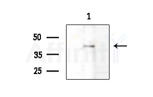ERK2 Antibody - Western blot analysis of extracts from Mouse lung, using ERK2 Antibody at 1/1000 dilution.