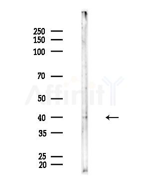 ERK2 Antibody - Western blot analysis of lysates from EC304 cells, using ERK2 Antibody at 1/1000 dilution.