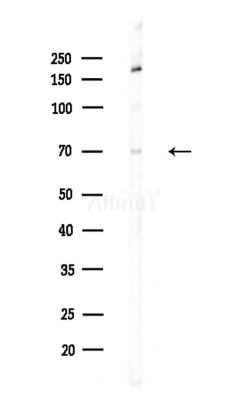 MTM1 Antibody - Western blot analysis of lysates from A375 cells(LPS,4h treatment), using MTM1 Antibody at 1/1000 dilution.