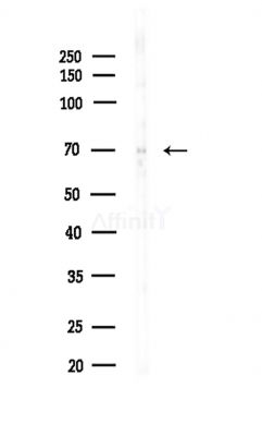 MTM1 Antibody - Western blot analysis of lysates from Mouse testis, using MTM1 Antibody at 1/1000 dilution.