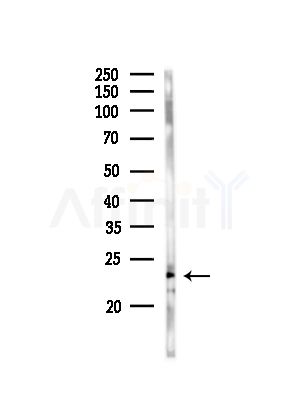 RhoA Antibody - Western blot analysis of lysates from Rat liver, using RhoA Antibody at 1/1000 dilution.