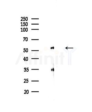 TUBA4A  Antibody - Western blot analysis of lysates from COLO205 cells, using TUBA4A  Antibody at 1/1000 dilution.