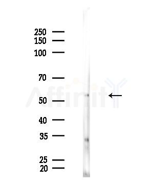 TUBA4A  Antibody - Western blot analysis of lysates from EC304 cells, using TUBA4A  Antibody at 1/1000 dilution.