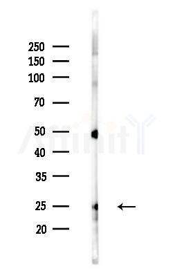 Interferon alpha 1 Antibody - Western blot analysis of lysates from B16F10-LUC cells(heat-shock,45min treatment), using Interferon alpha 1 Antibody at 1/1000 dilution.