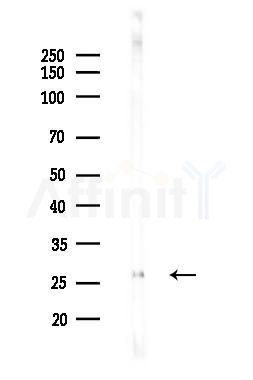 CD40L Antibody - Western blot analysis of lysates from Hela cells(LPS 4h treatment), using CD40L Antibody at 1/1000 dilution.