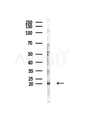 TGF alpha Antibody - Western blot analysis of lysates from 293 cells(LPS,4h treatment), using TGF alpha Antibody at 1/1000 dilution.