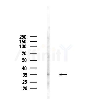 CDCA8 Antibody - Western blot analysis of lysates from A375 cells(starvation,24h treatment), using CDCA8 Antibody at 1/1000 dilution.