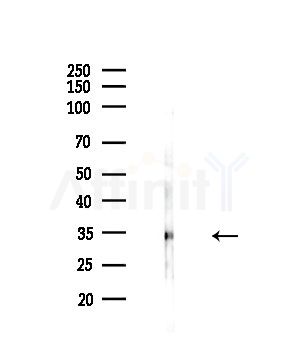 CDCA8 Antibody - Western blot analysis of lysates from HepG2 cells(LPS,4h treatment), using CDCA8 Antibody at 1/1000 dilution.