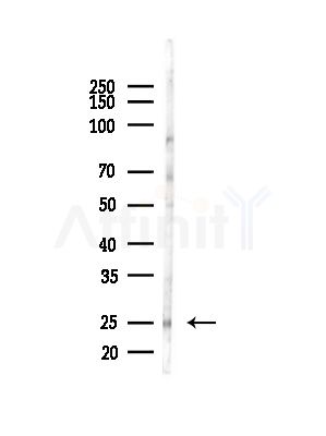 SMNDC1 Antibody - Western blot analysis of lysates from COLO205 cells(heat-shock,45min treatment), using SMNDC1 Antibody at 1/1000 dilution.
