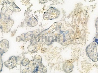STEA3 Antibody - DF6122 at 1/100 staining human normal placenta tissue by IHC-P.