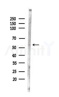 STEA3 Antibody - Western blot analysis of lysates from Rat liver, using STEA3 Antibody at 1/1000 dilution.