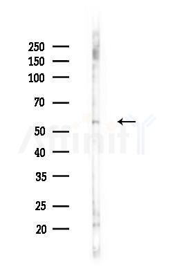 ILK Antibody - Western blot analysis of lysates from B16F10-LUC cells(heat-shock,45min treatment), using ILK Antibody at 1/1000 dilution.