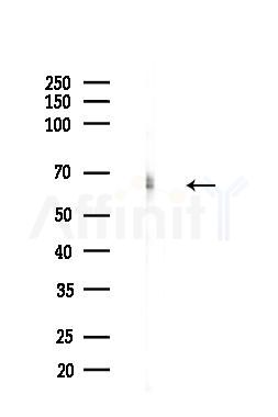 GAD2 Antibody - Western blot analysis of lysates from Rat brain, using GAD2 Antibody at 1/1000 dilution.