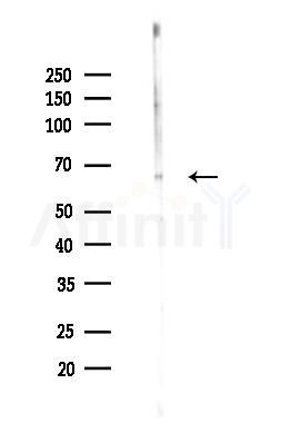 GAD2 Antibody - Western blot analysis of lysates from B16F10-LUC cells(heat-shock,45min treatment), using GAD2 Antibody at 1/1000 dilution.