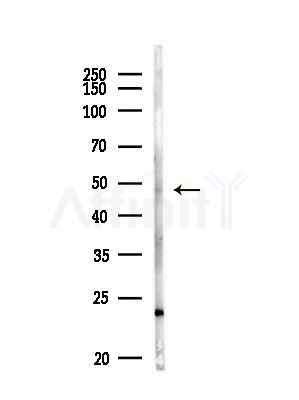 EEF1A1 Antibody - Western blot analysis of lysates from MDA-MB-231 cells(heat-shock,45min treatment), using EEF1A1 Antibody at 1/1000 dilution.
