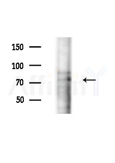 NEK8 Antibody - Western blot analysis of extracts from EC304 cells(heat-shock,45min treatment), using NEK8 Antibody at 1/1000 dilution.