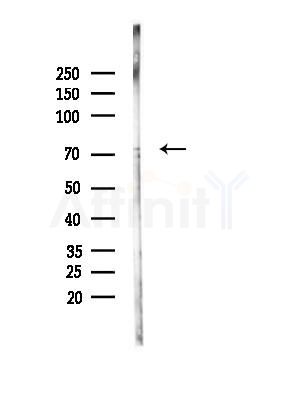 NEK8 Antibody - Western blot analysis of lysates from EC304 cells(heat-shock,45min treatment), using NEK8 Antibody at 1/1000 dilution.