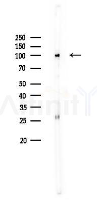 Hexokinase II Antibody - Western blot analysis of lysates from HUVEC cells, using Hexokinase II Antibody at 1/1000 dilution.