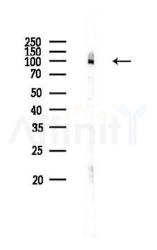 Hexokinase II Antibody - Western blot analysis of lysates from Rat testis, using Hexokinase II Antibody at 1/1000 dilution.