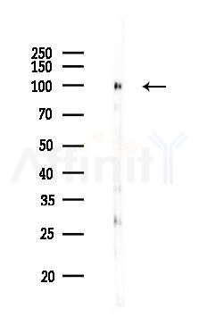 Hexokinase II Antibody - Western blot analysis of lysates from COLO205 cells, using Hexokinase II Antibody at 1/1000 dilution.