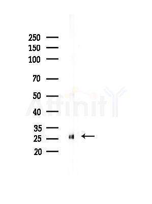 Carbonic Anhydrase 1/CA1 Antibody - Western blot analysis of lysates from Mouse liver, using Carbonic Anhydrase 1/CA1 Antibody at 1/1000 dilution.