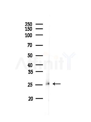 PSMB1 Antibody - Western blot analysis of lysates from Mouse testis, using PSMB1 Antibody at 1/1000 dilution.