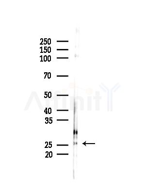 PSMB1 Antibody - Western blot analysis of lysates from MDA-MB-231 cells(heat-shock,45min treatment), using PSMB1 Antibody at 1/1000 dilution.