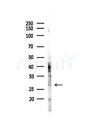 EDN3 Antibody - Western blot analysis of lysates from Hela cells(heat-shock,45min treatment), using EDN3 Antibody at 1/1000 dilution.