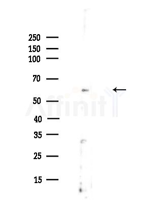GSS Antibody - Western blot analysis of lysates from A375 cells(heat-shock,45min treatment), using GSS Antibody at 1/1000 dilution.