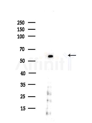 GSS Antibody - Western blot analysis of lysates from HUVEC cells(UV,30min treatment), using GSS Antibody at 1/1000 dilution.