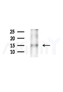 DEFB132 Antibody - Western blot analysis of extracts from B16F10-LUC cells(starvation,24h treatment), using DEFB132 Antibody at 1/1000 dilution.
