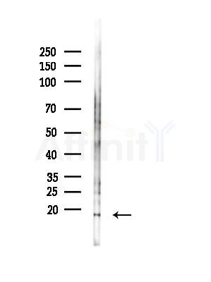 DEFB132 Antibody - Western blot analysis of lysates from B16F10-LUC cells(starvation,24h treatment), using DEFB132 Antibody at 1/1000 dilution.
