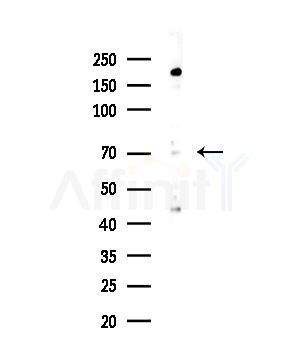 NUAK2 Antibody - Western blot analysis of lysates from COLO205 cells, using NUAK2 Antibody at 1/1000 dilution.
