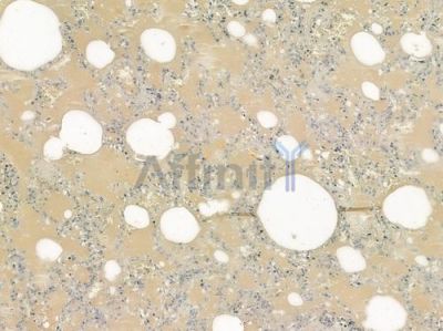 FAM3B Antibody - DF6227 at 1/100 staining human normal lung tissue by IHC-P.