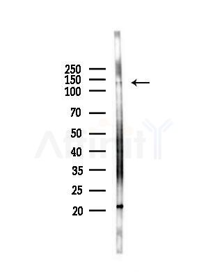 AMBRA1 Antibody - Western blot analysis of lysates from Hela cells(heat-shock,45min treatment), using AMBRA1 Antibody at 1/1000 dilution.