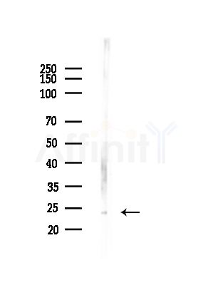 UBE2K Antibody - Western blot analysis of lysates from Rat brain, using UBE2K Antibody at 1/1000 dilution.