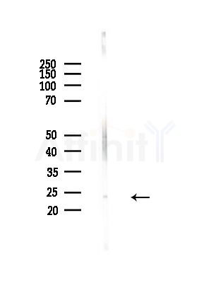 UBE2K Antibody - Western blot analysis of lysates from Hela cells(heat-shock,45min treatment), using UBE2K Antibody at 1/1000 dilution.