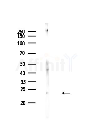 UBE2K Antibody - Western blot analysis of lysates from A375 cells(LPS,4h treatment), using UBE2K Antibody at 1/1000 dilution.