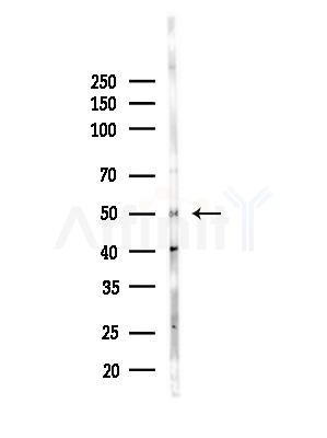 TYMP Antibody - Western blot analysis of lysates from Hela cells(heat-shock,45min treatment), using TYMP Antibody at 1/1000 dilution.