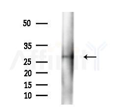 CRH Antibody - Western blot analysis of lysates from EC304 cells(heat-shock,45min treatment), using CRH Antibody at 1/1000 dilution.