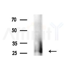 CRH Antibody - Western blot analysis of lysates from B16F10-LUC cells(starvation,24h treatment), using CRH Antibody at 1/1000 dilution.