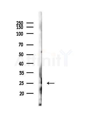 CRH Antibody - Western blot analysis of lysates from B16F10-LUC cells(starvation,24h treatment), using CRH Antibody at 1/1000 dilution.