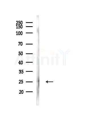 CRH Antibody - Western blot analysis of lysates from EC304 cells(heat-shock,45min treatment), using CRH Antibody at 1/1000 dilution.