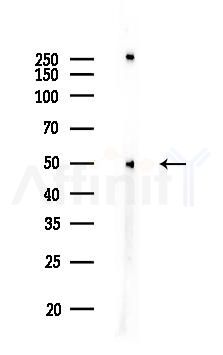 ATG4C Antibody - Western blot analysis of lysates from COLO205 cells, using ATG4C Antibody at 1/1000 dilution.
