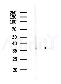 TNNT2 Antibody - Western blot analysis of lysates from Rat testis, using TNNT2 Antibody at 1/1000 dilution.