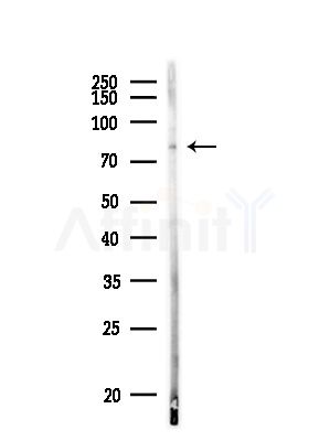 MCM7 Antibody - Western blot analysis of lysates from MDA-MB-231 cells(heat-shock,45min treatment), using MCM7 Antibody at 1/1000 dilution.